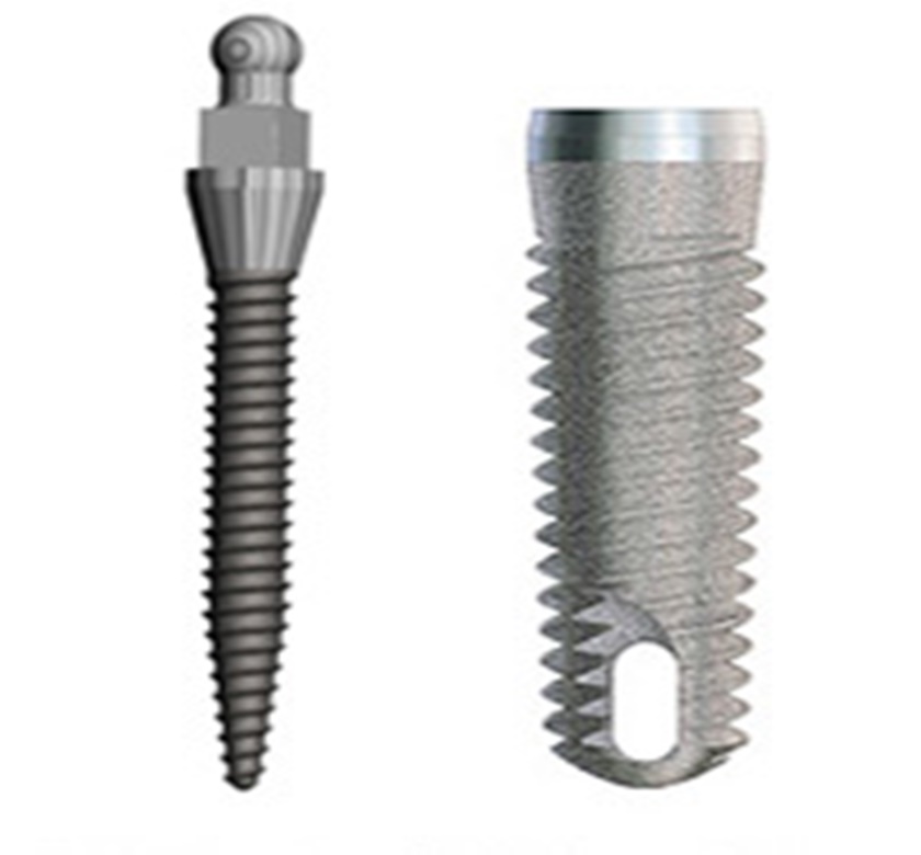 Mini Implant được cấy ghép hoàn chỉnh